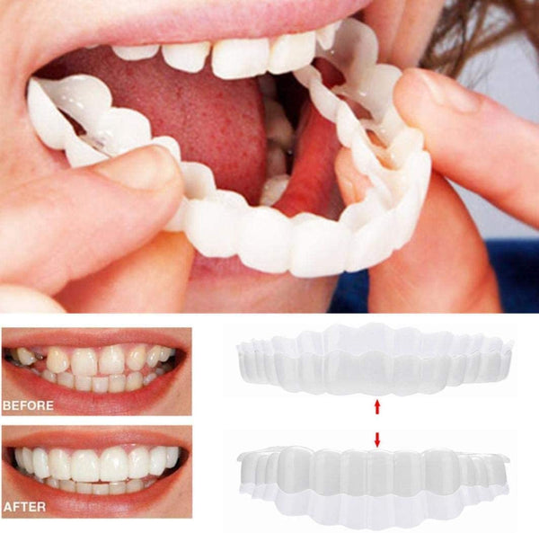 Nakładki Na Zęby Licówki | Sztuczne Zęby-Dentures-Polizatto