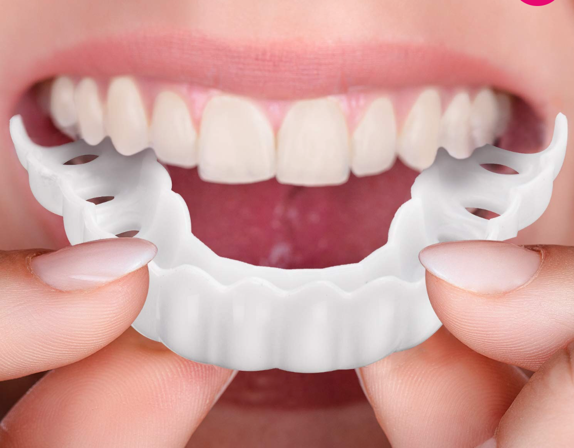 Licówki Tymczasowe | Snap-on Smile-Dentur-Polizatto