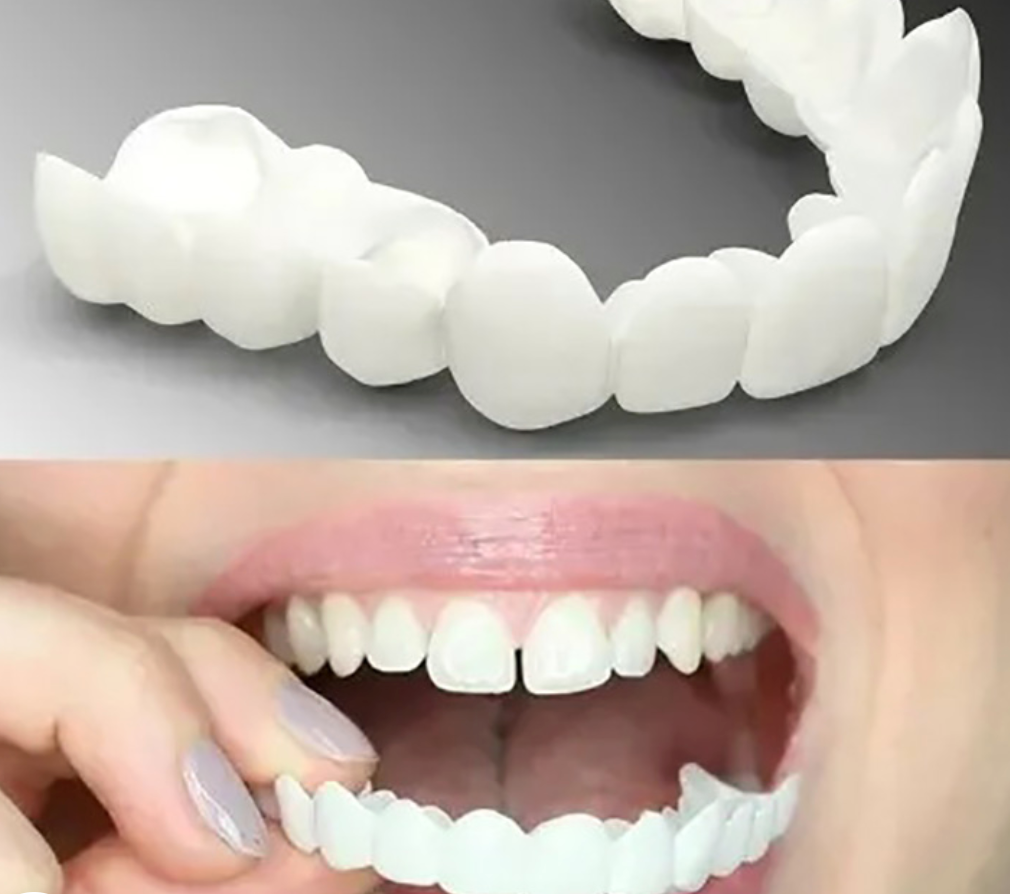 Licówki Tymczasowe | Snap-on Smile-Dentur-Polizatto